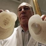 Plastic surgeon Denis Boucq poses with silicone gel breast implants manufactured by French company Poly Implant Prothese (PIP) in a clinic in Nice