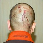 photograph released by Florida authorities shows blood on the head of George Zimmerman, charged with second-degree murder in the shooting death of teenager Trayvon Martin during a confrontation in Sanford. Zimmerman says it was self-defense. (State Attorney's Office, AFP/Getty Images / May 17, 2012)