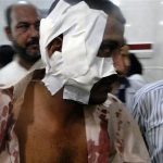 A man receives treatment at a hospital after a car bombing, in Kut, 150 km (93 miles) southeast of Baghdad, July 4, 2012. REUTERS/Stringer