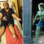 I swell up like the Incredible Hulk Woman's muscles bulge and body balloons during anger attacks