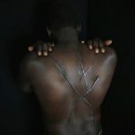 Hassan Mekki, a 32-year-old Sudanese migrant, shows scars on his back in Athens December 5, 2012. REUTERS/Yannis Behrakis
