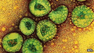 Second UK case of 'Sars-like' coronavirus identified