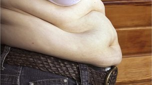 'Apple shape' linked to higher risk of kidney disease