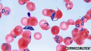 Parasite 'resistant to malaria drug artemisinin'