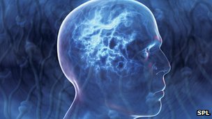 Brain implant 'predicts' epilepsy seizures