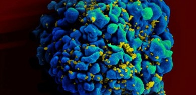 Scientists on brink of HIV cure within months