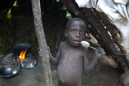 In this May 22, 2013 photo, a malnourished 5-year-old Dieufort Jean stands in his kitchen holding a spoon as he waits for a meal in the community of Mabriole near the town of Belle Anse in Haiti. Mabriole town official Geneus Lissage fears that death is imminent for these children if Haitian authorities and humanitarian workers don't do more to stem the hunger problems. (AP Photo/Dieu Nalio Chery)