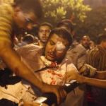 Supporters of deposed Egyptian president Mohamed Mursi help a fellow protester, who eye is injured by pellets, into a pick-up during clashes on the 6th October Bridge and Ramses square in central Cairo early July 16, 2013. REUTERS/Asmaa Waguih
