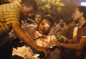 Supporters of deposed Egyptian president Mohamed Mursi help a fellow protester, who eye is injured by pellets, into a pick-up during clashes on the 6th October Bridge and Ramses square in central Cairo early July 16, 2013. REUTERS/Asmaa Waguih