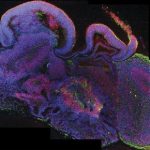 Handout photo of a cross-section of an entire organoid showing development of different brain regions