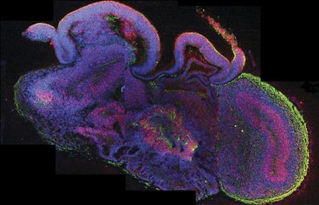 Handout photo of a cross-section of an entire organoid showing development of different brain regions