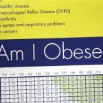 A sign hanging in bariatric surgeon Dr. Michael Snyder's office shows some of the risks of obesity including stroke, sleep apnea and cancer Denver