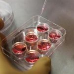 An employee demonstrates the process to extract eggs in a lab at the e-Stork Reproductive Center in Hsinchu