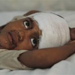 a 6-year-old girl injured in communal clashes