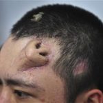 nose on man's forehead