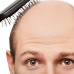 Baldness treatment a 'step closer'