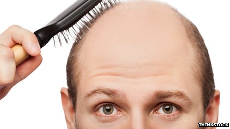 Baldness treatment a 'step closer'
