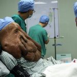 China man, 17.5kg tumour