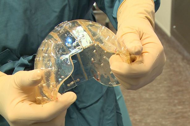 The plastic skull created using a 3D printer - Photo: Rex