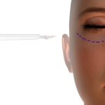 Plastic Surgery On Female Face