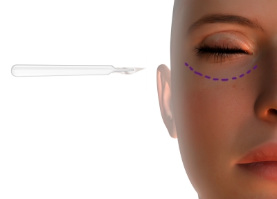 Plastic Surgery On Female Face