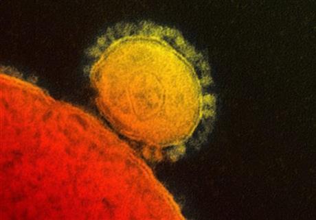 MERS virus