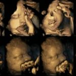 fetuses react