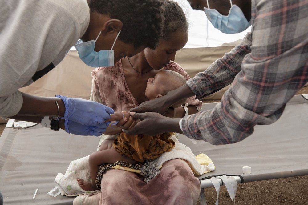 A Tigray woman who fled the conflict in Ethiopia's Tigray region, holds her malnourished and severely dehydrated baby as nurses give him IV fluids, at the Medecins Sans Frontieres (MSF) clinic