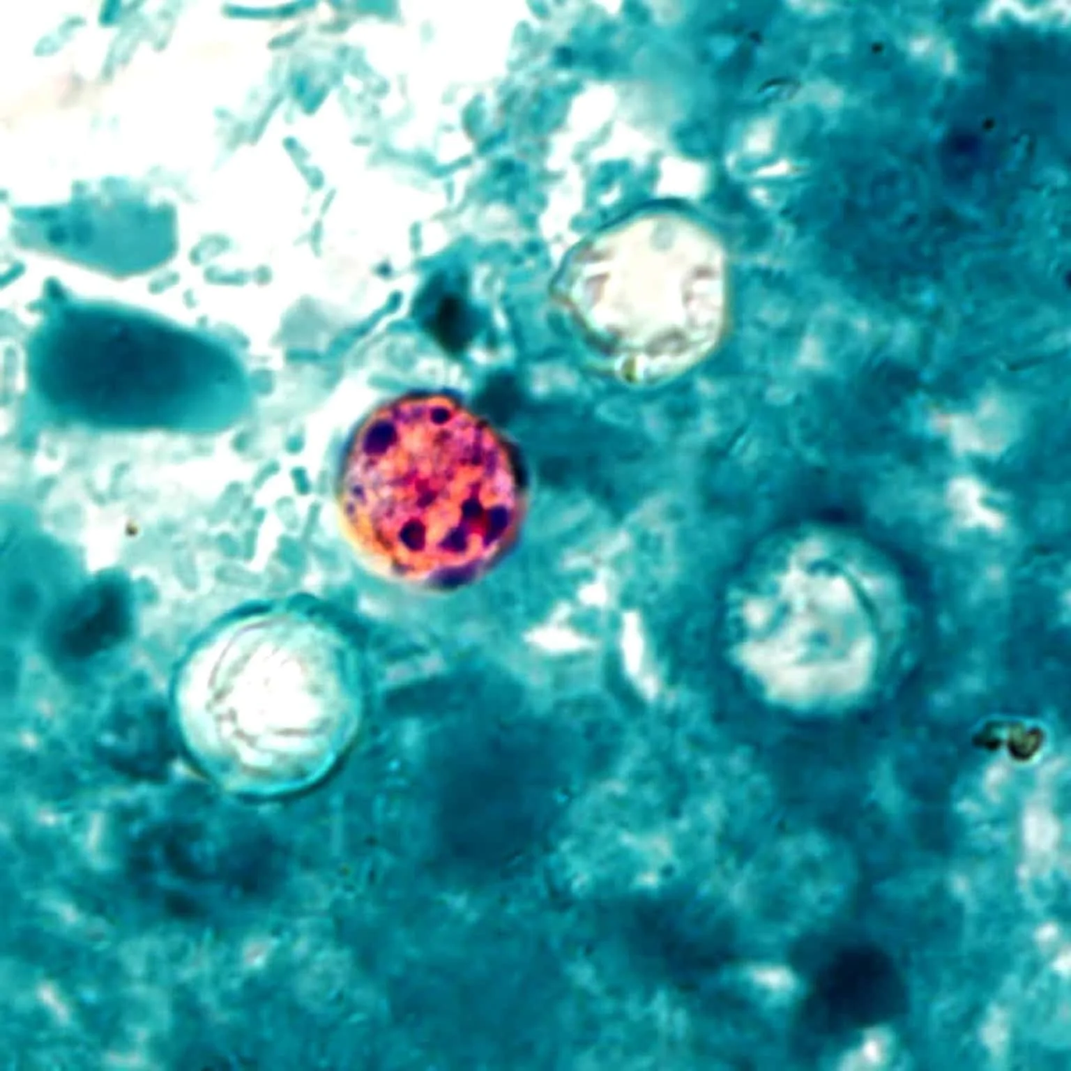 Cyclospora cayetanensis.